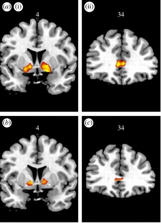 Depiction of brain activity from Clark (2010) https://doi.org/10.1098/rstb.2009.0147